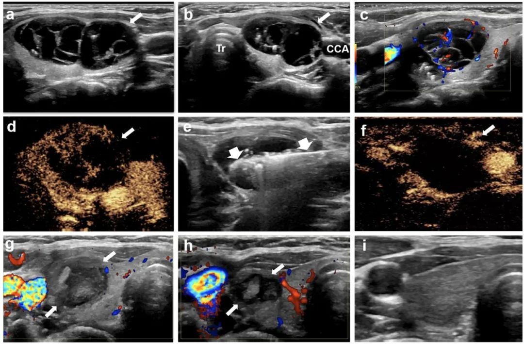 1702614130491 640 (2)